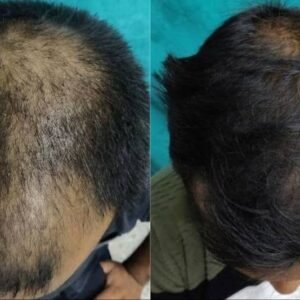Hair Oil 3 Months कोर्स